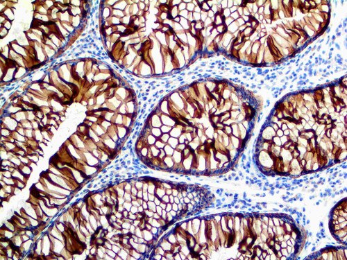 IHC of Cytokeratin 8 on an FFPE Colon Tissue